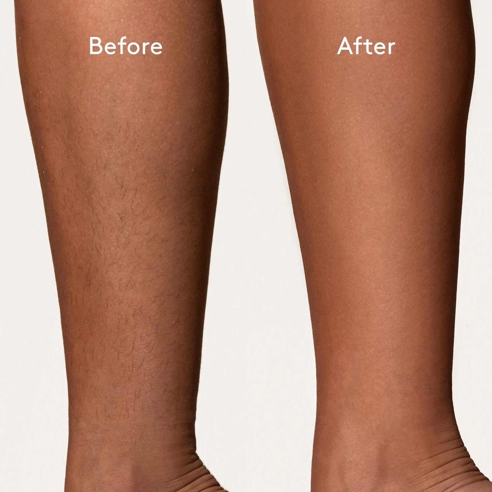 Hair Removal Soft Creme Wax Honey Tea Tree Rose Depilation Waxing 450g Pot