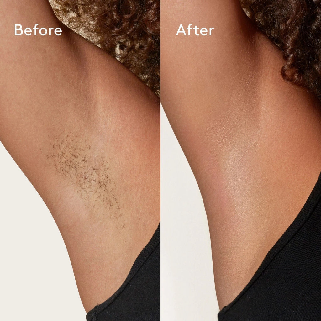 Hair Removal Soft Creme Wax Honey Tea Tree Rose Depilation Waxing 450g Pot