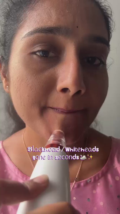 Blackhead Removal Tool