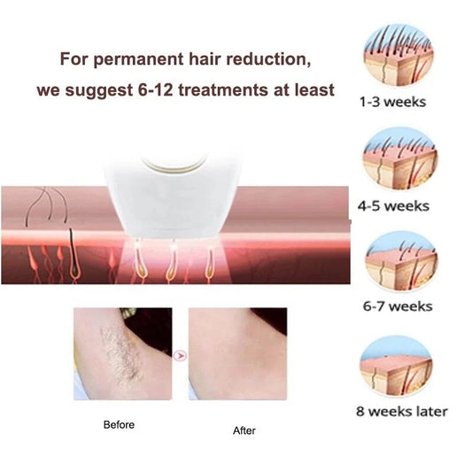 IPL Hair Removal Device – Permanent Hair Reduction for Face & Body