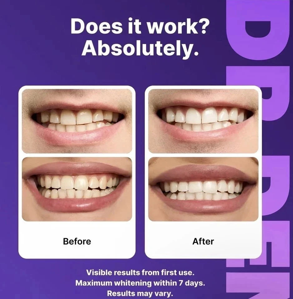 DR Dent Purple Whitening Strips